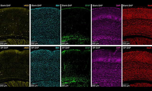 نورون‌های نوع I nNOS (به رنگ زرد) نسبت به سایر انواع نورون‌ها بسیار کمتر هستند و توسط پژوهشگران به‌طور انتخابی حذف شدند.