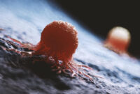 حل معمای صدساله سرطان با توان هوش مصنوعی