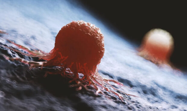 حل معمای صدساله سرطان با توان هوش مصنوعی